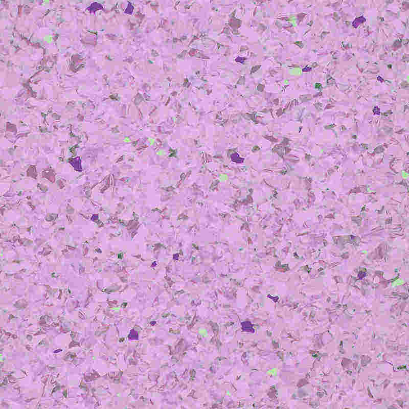 Mekani i umirujući homogeni podovi